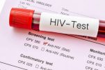 تاکنون ۱۶۹ بیمار مبتلا به «HIV» در استان ایلام شناسایی شده است